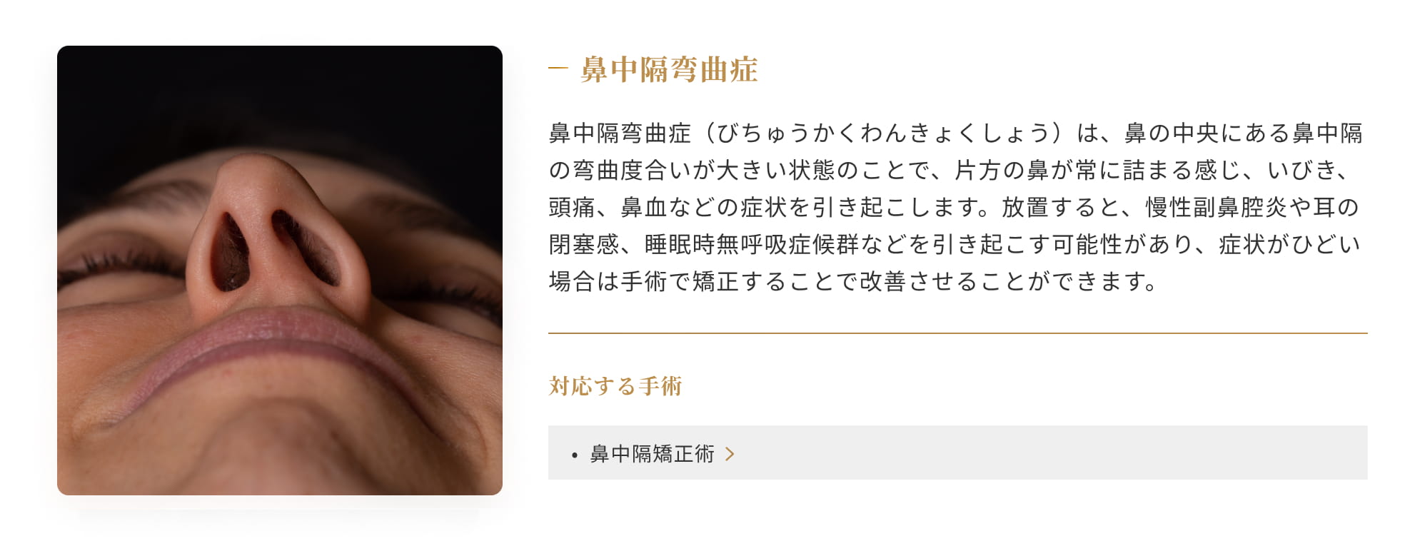 ⿐中隔弯曲症