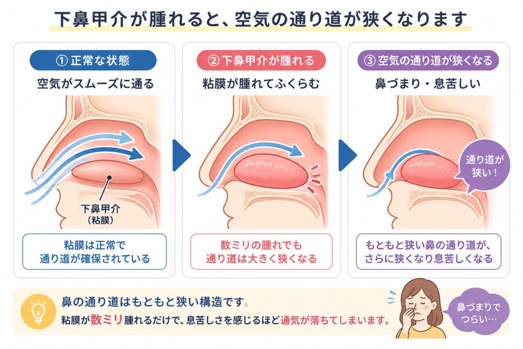 下鼻甲介が腫れると空気の通り道が狭くなる仕組み
